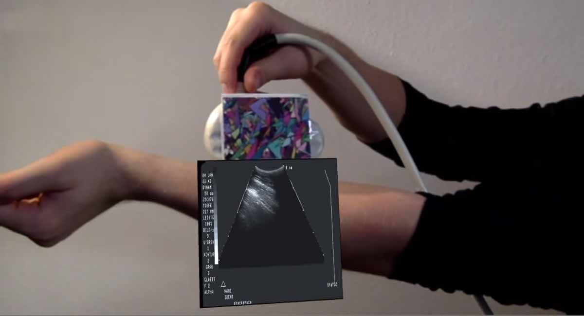 Augmented Reality: Ultraschall in Echtzeit