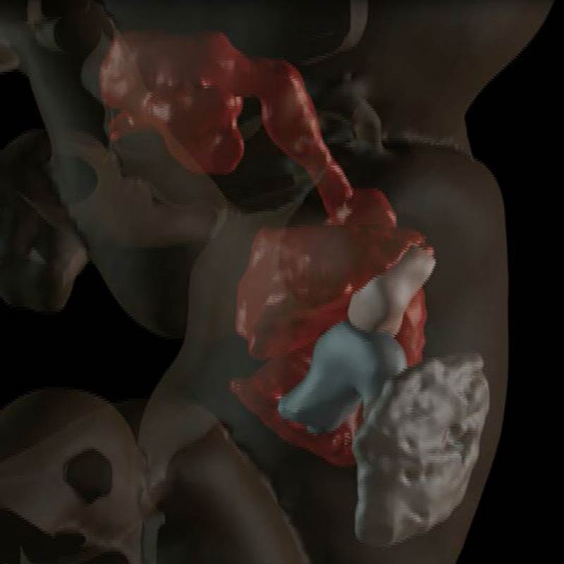 Auch die inneren Organe des Fötus können visualisiert und virtuell untersucht werden. Bild: RSNA