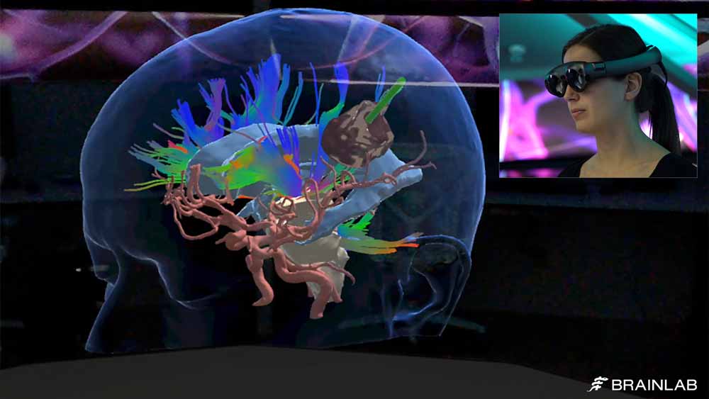 Die 3D-Visualisierung mit Magic Leap One soll Medizinern die Arbeit erleichtern. Bild: Brainlab