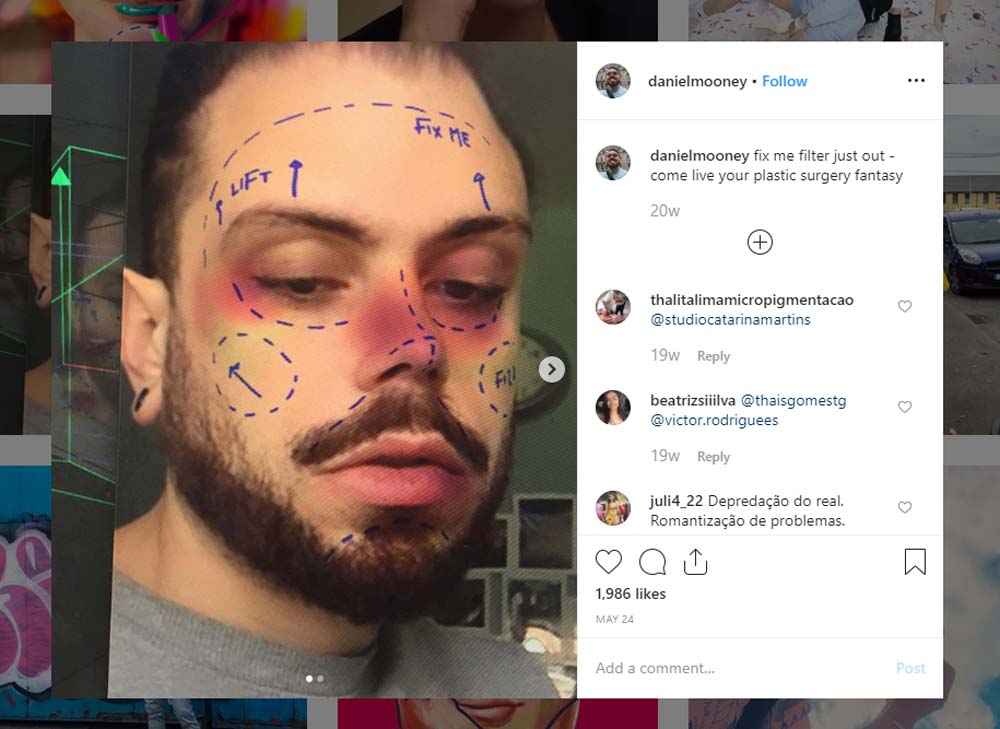 AR-Filter für Schönheitschirurgie sorgt für Instagram-Kontroverse