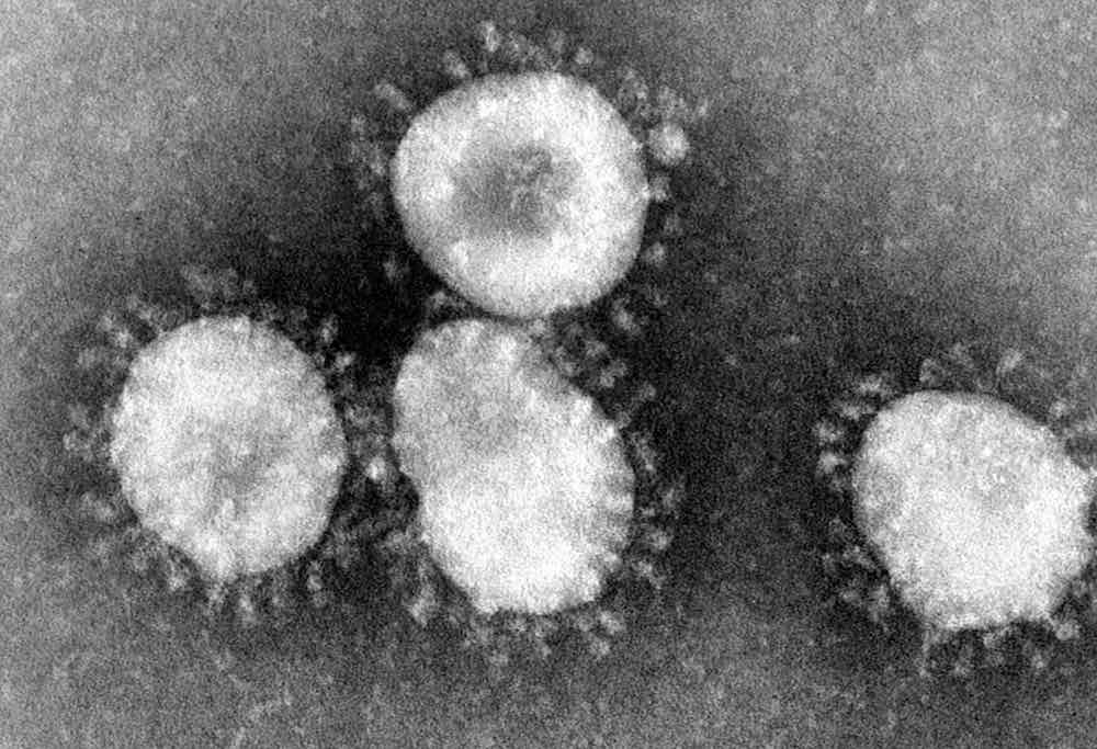 Coronavirus: Künstliche Intelligenz unterstützt Ärzte bei der Diagnose