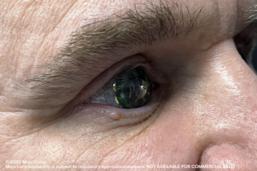 Ein Mann trägt eine Mojo Lens im Auge, man sieht sein Auge in der Nahaufnahme.