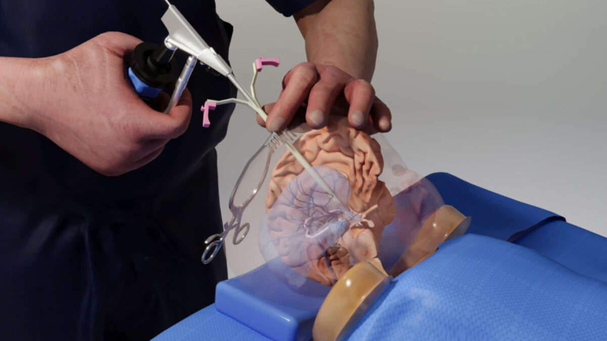 Benjamin Warf, a renowned neurosurgeon at Boston Children’s Hospital, demonstrates a technique in virtual reality. Those techniques include a procedure to treat infant hydrocephalus that was pioneered by Warf, the director of neonatal and congenital neurosurgery at Boston Children’s Hospital. In the synchronous mode, Warf operates his avatar from a distance in real time while medical residents in Brazil watch, interact, and learn in a 3D environment.